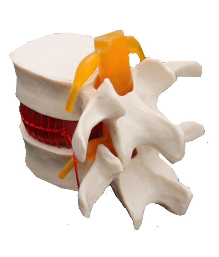 Simulateur de hernie discale