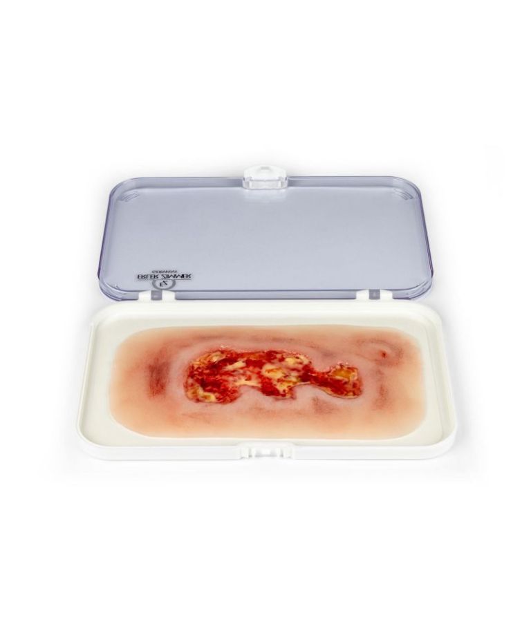 Plaie simulée d'ulcère veineux de jambe, petit, en phase d'exsudation