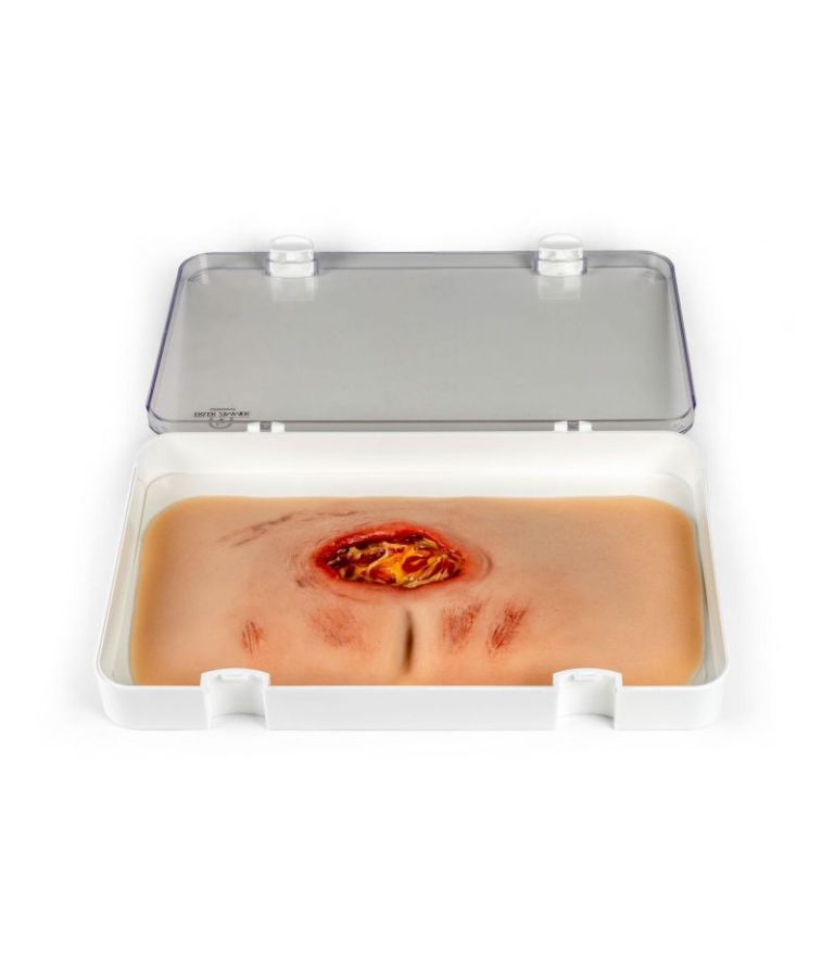 moulage de plaie, escarre sacrée, nettoyé
